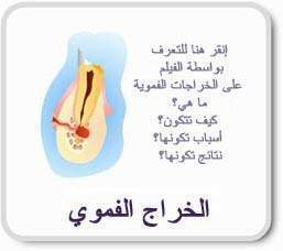 Inhabit teeth ached in cases of emergency