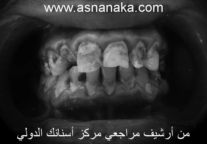 �������� � . � . �� ������ ��� ����� ������� 