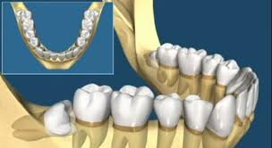 علاقة الصداع بأمراض الفم والأسنان