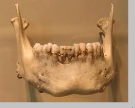 مختصر تاريخ طب الأسنان منتدى أسنانك